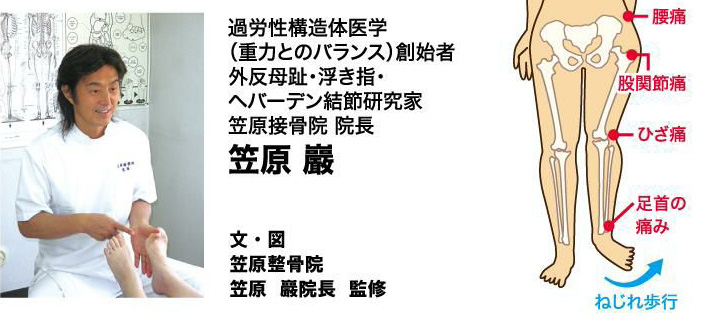 足の専門家が助言 外反母趾から股関節への障害発生